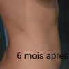 Deux rendez-vous et j'ai vu le résultat !