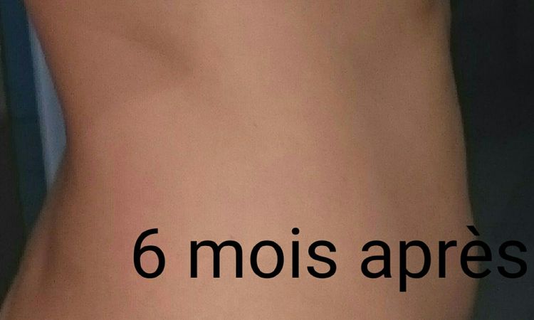 863