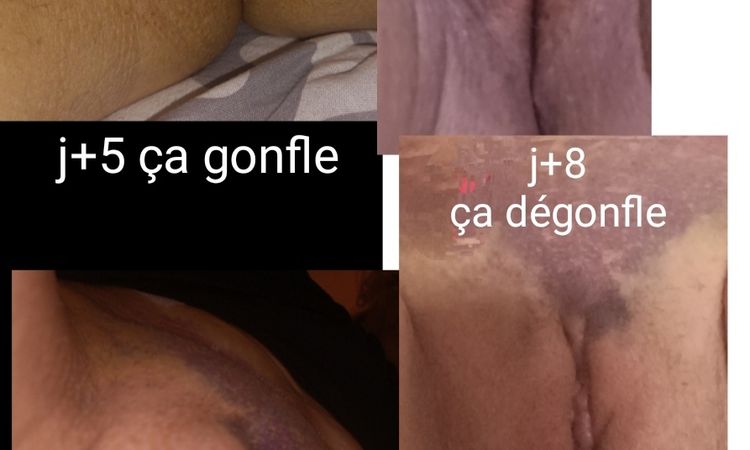 145126