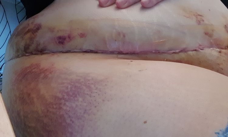 122101