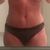 Une abdominoplastie qui a changé ma vie