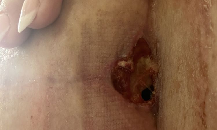 147485