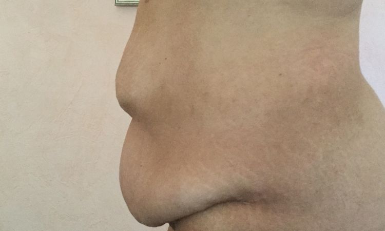 55761