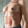 Mon augmentation mammaire pas à pas : de l’angoisse au ravissement !