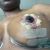 Chirurgie avec implants Motiva : Augmentation mammaire et lifting