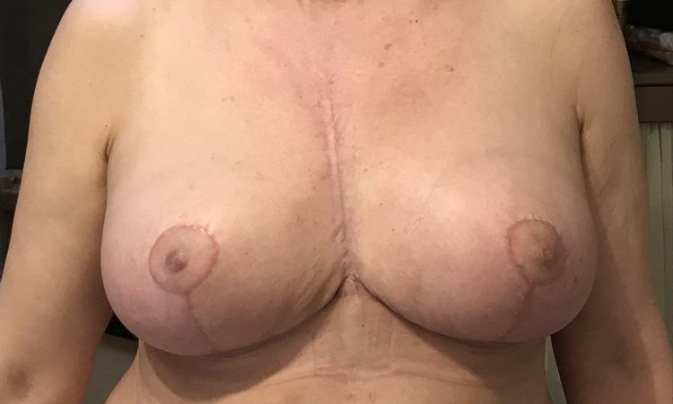 131206