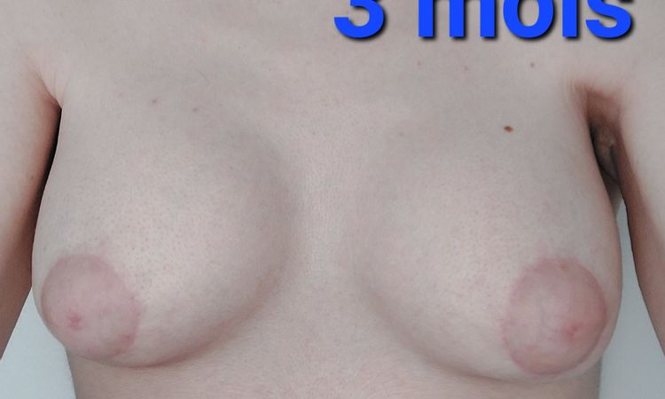 133515