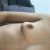 Mastopexie petite poitrine sans augmentation mammaire