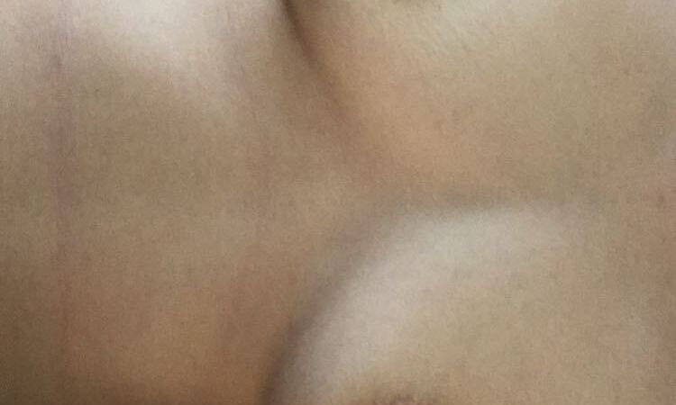 125681