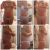 Abdominoplastie réussie !