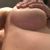 Augmentation mammaire 390/360cc
