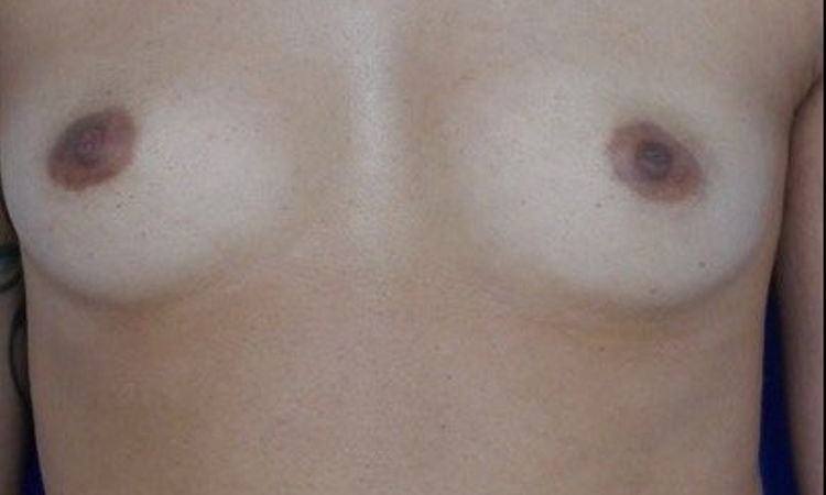 80613