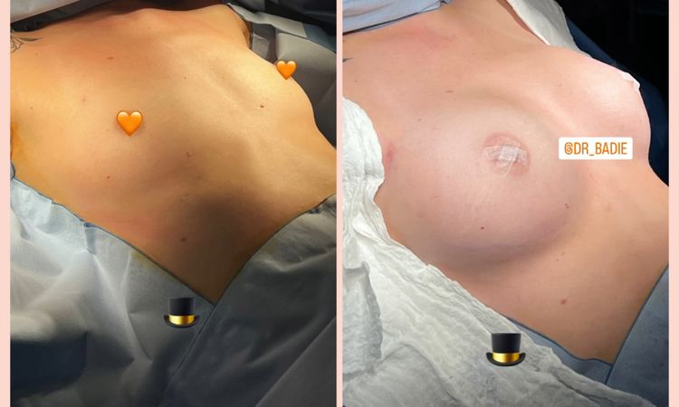 135114