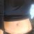 Jour +1 après mon abdominoplastie