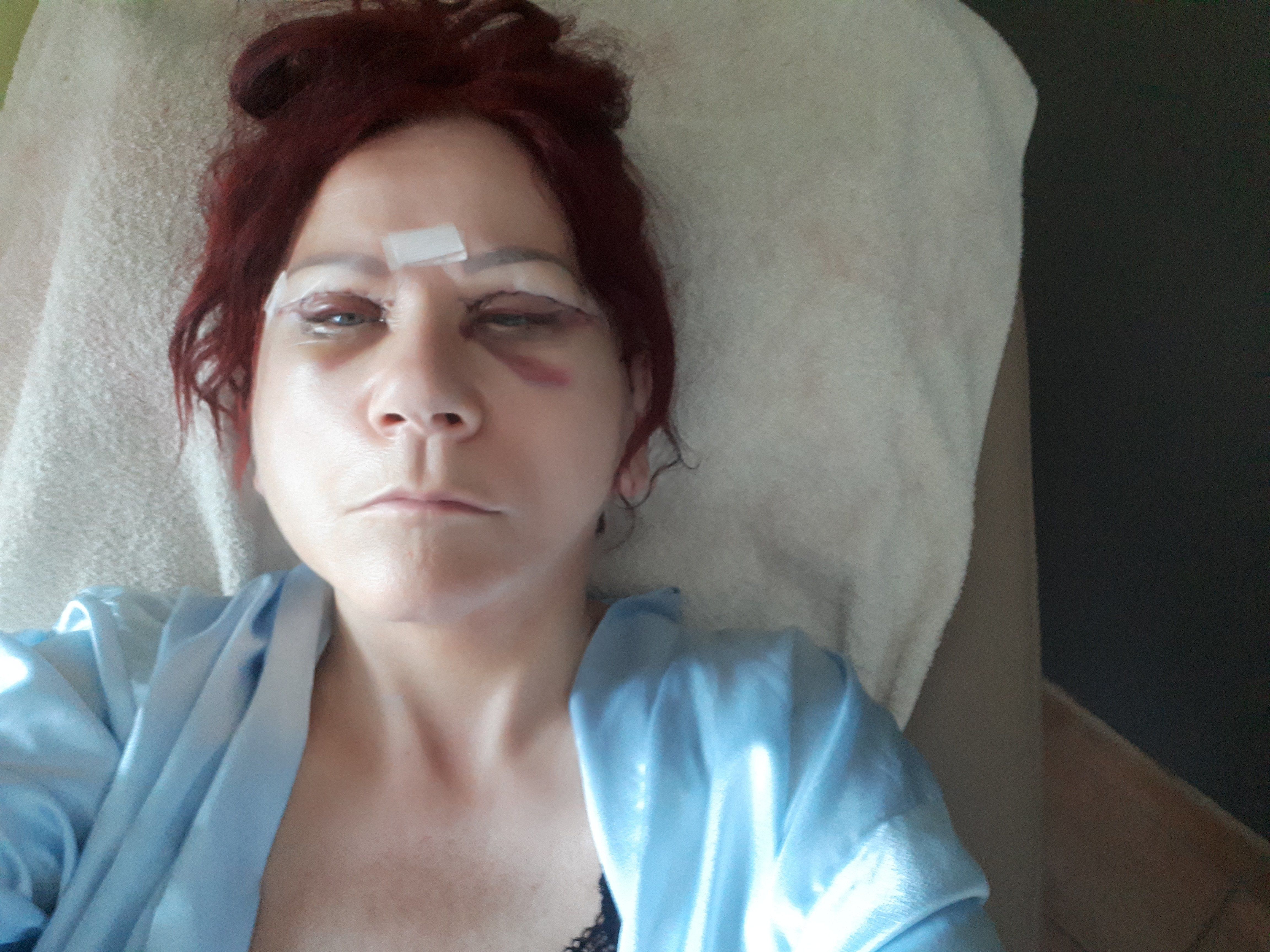 2615