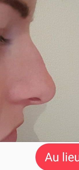 3964