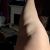 Lifting des cuisses internes et des genoux