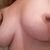 Lifting des seins + lipofilling, j ai franchis le Cap !