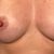 Heureuse avec Motiva: Augmentation mammaire, en route pour enfin se sentir femme !