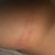 Implants Motiva: Mon augmentation mammaire 6 mois post op