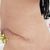 Mon expérience d abdominoplastie