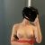 Augmentation Mammaire par voie axillaire 200 cc