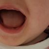 Double lèvre bébé 8 mois