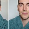 Amélioration du visage : questions et avis