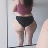 Liposuccion de la culotte de cheval