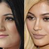 ✌️ Le jeu des Stars : Avant ou Après ? Kylie Jenner