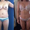 Le Mommy Makeover, vous en pensez quoi ?