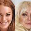 ✌️ Le jeu des Stars : Avant ou Après ? Lindsay Lohan