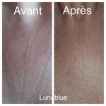 Anonyme