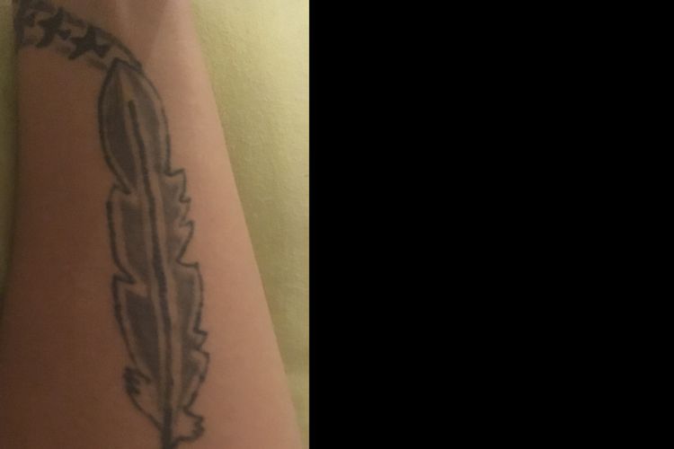 je voudrais retiré mon tatouage