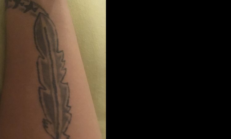 je voudrais retiré mon tatouage - 3225