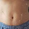 Cryolipolyse ou lipolaser