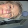 quoi faire taches, peau ridée 66 ans ?