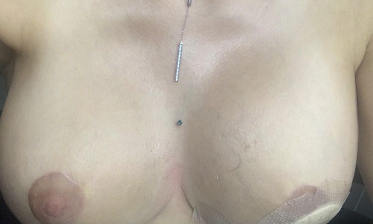 Est-il possible de venir à bout d'un staphylocoque doré ? - 45539