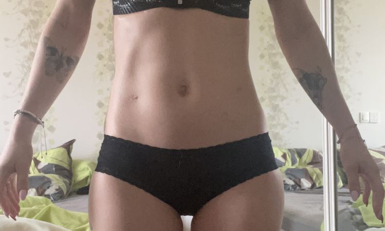 Refus taille de prothèse par le chirurgien - 49673