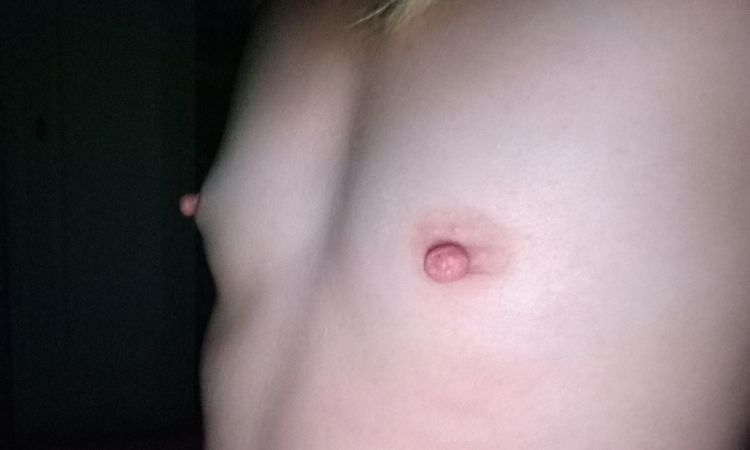 Augmentation mammaire et PEC - 53255