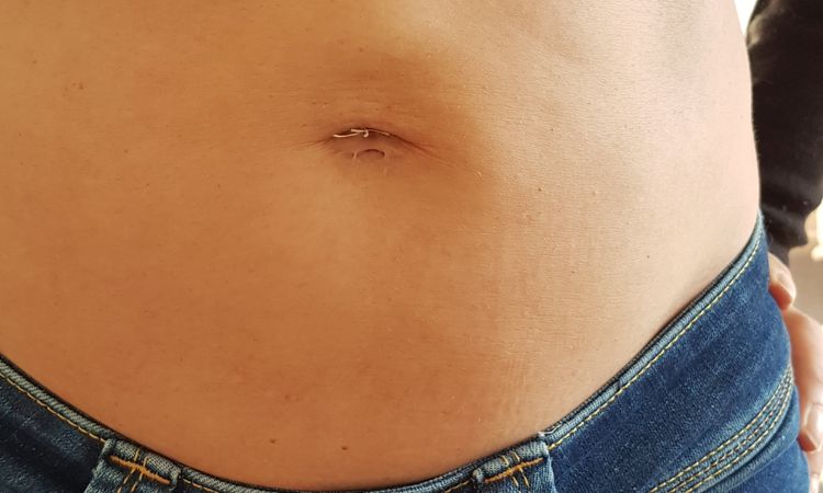 Boule dure au-dessus du nombril après liposuccion - 59461