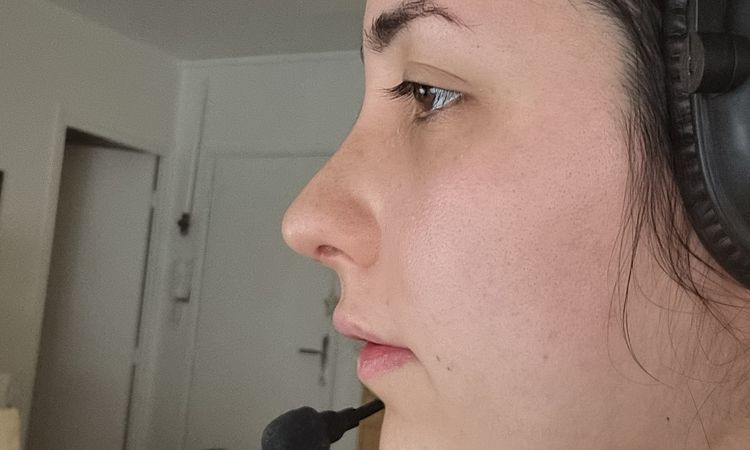 Projection nez après rhinoplastie - 60278