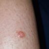 Avis sur un bouton qui gratte