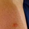 Avis sur un bouton qui gratte