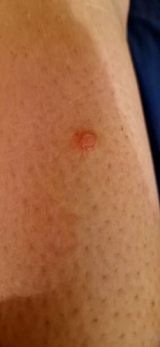 Avis sur un bouton qui gratte