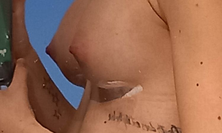 Prothèses trop hautes ? Trop grosses ? - 64352