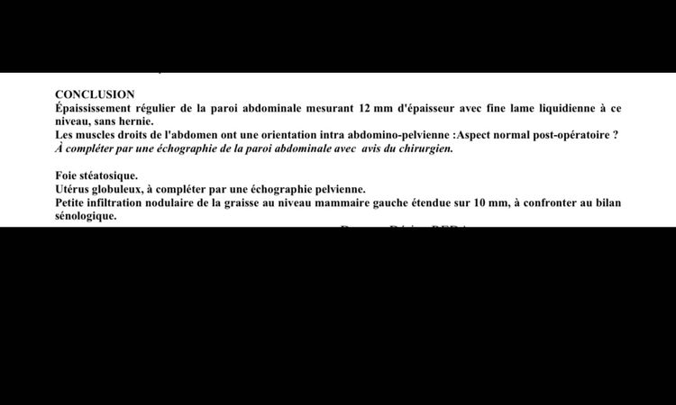 Fortes douleurs à plus d'un an post-opératoire d'une abdominoplastie - 70477