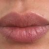 Taches brunes sur les lèvres - 73815