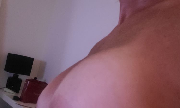 Augmentation mammaire réalisée il y a 10 ans - 77011