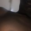 Gynécomastie sans chirurgie